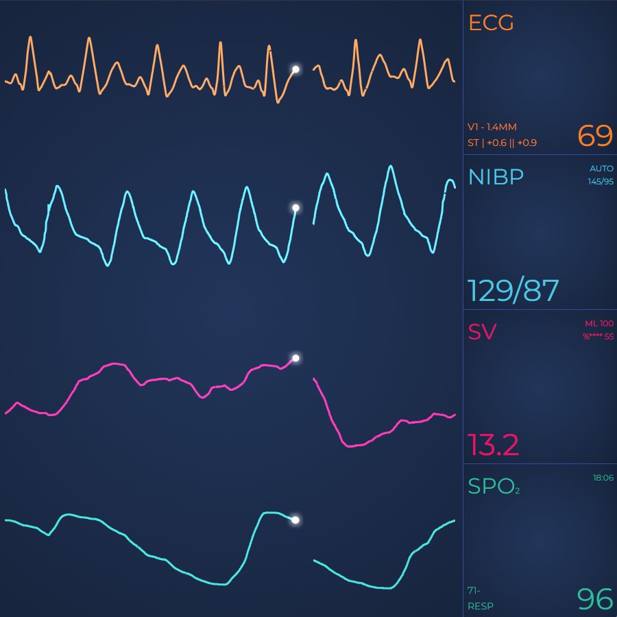 JavaScript Vital Signs ECG/EKG Medical Demo | SciChart.js Demo